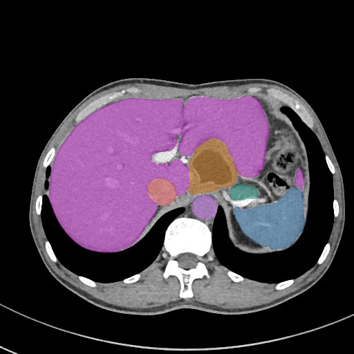 AMOS22 — Abdominal Multi-Organ preview