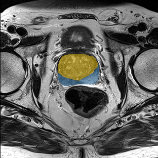 Medical Decathlon — PROSTATE preview