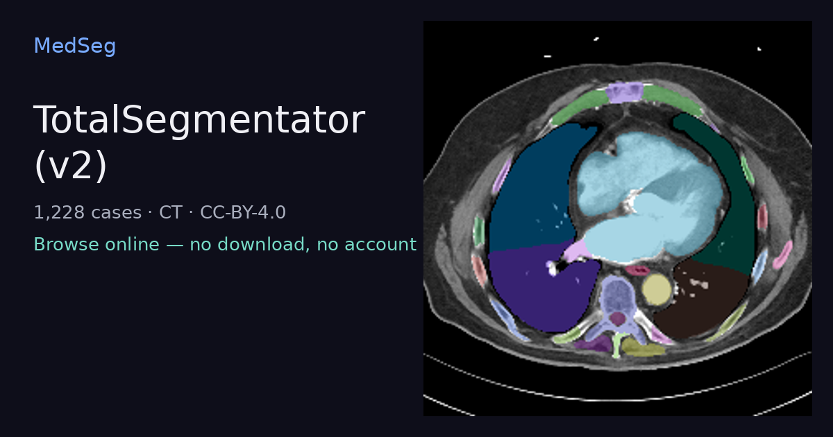 TotalSegmentator (v2) — example case rendered in the MedSeg editor