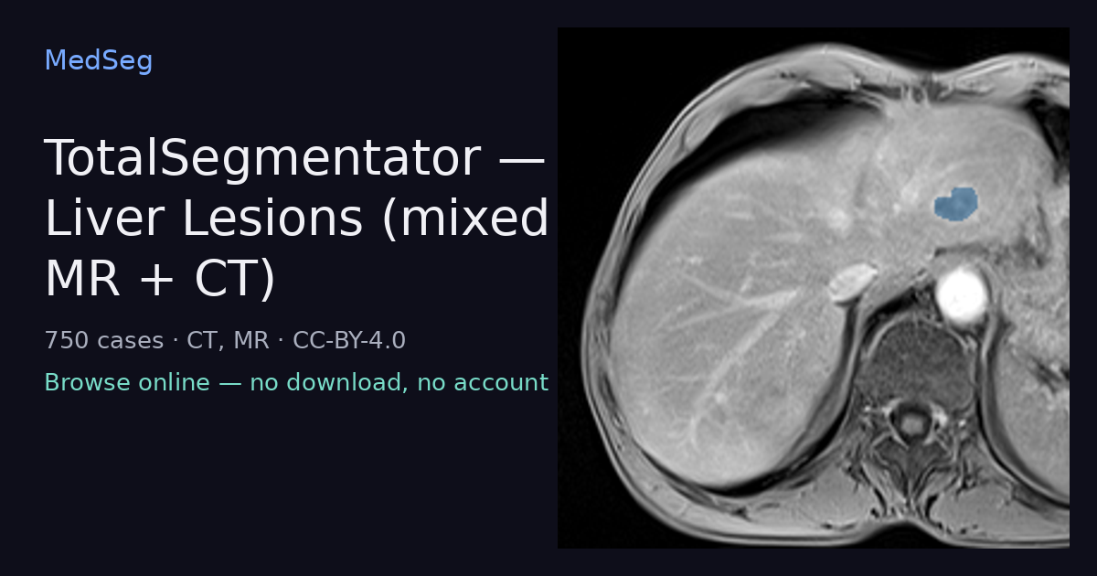 TotalSegmentator — Liver Lesions (mixed MR + CT) — example case rendered in the MedSeg editor