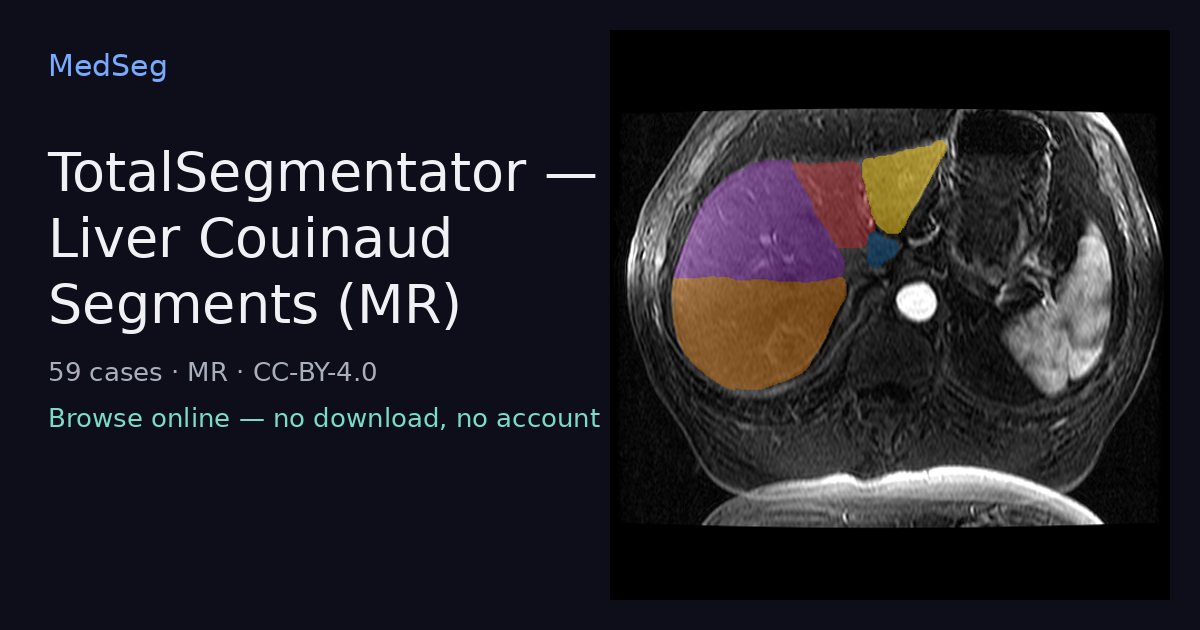 TotalSegmentator — Liver Couinaud Segments (MR) — example case rendered in the MedSeg editor